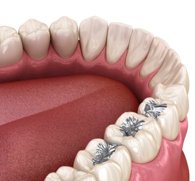 Dental Examination